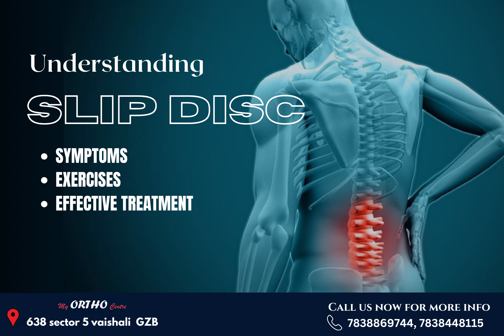 Slip Disc